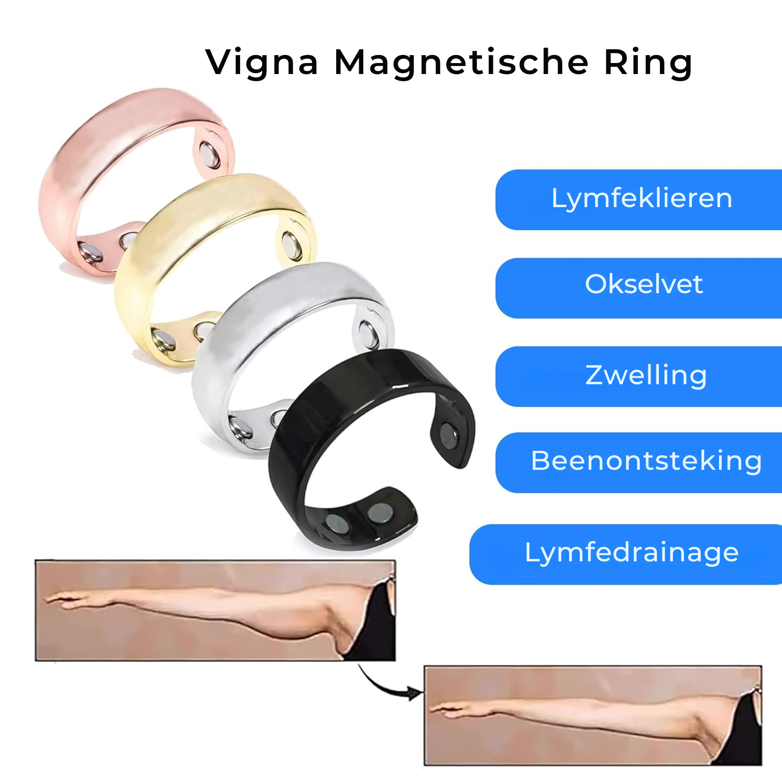 Vigna Magnetische Ring - Verlicht Pijn en Bevorder Gezondheid