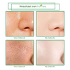 PoriTea Klei Masker Stick – Acne & Porie Reiniging