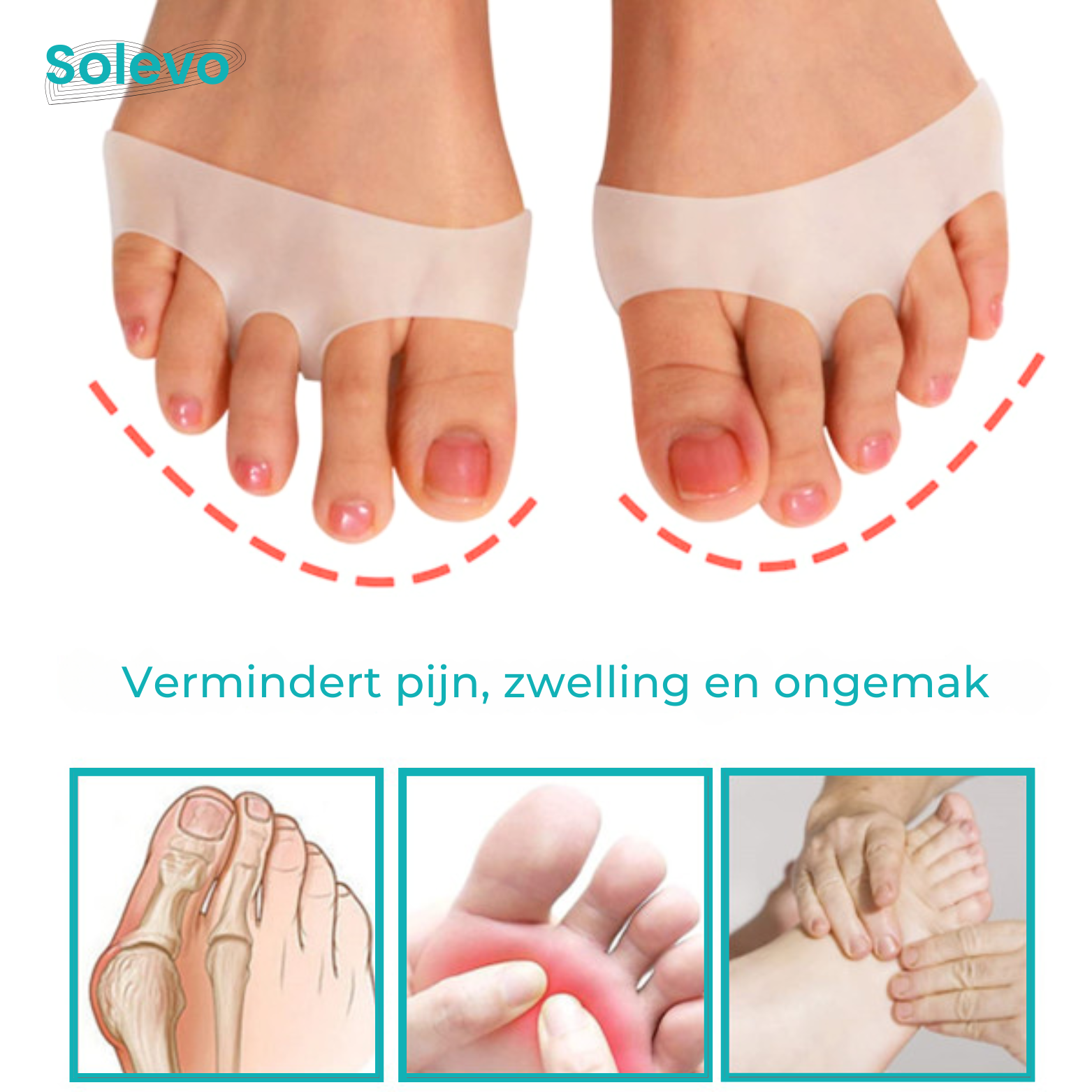 Solevo Voorvoetkussens tegen Voetpijn