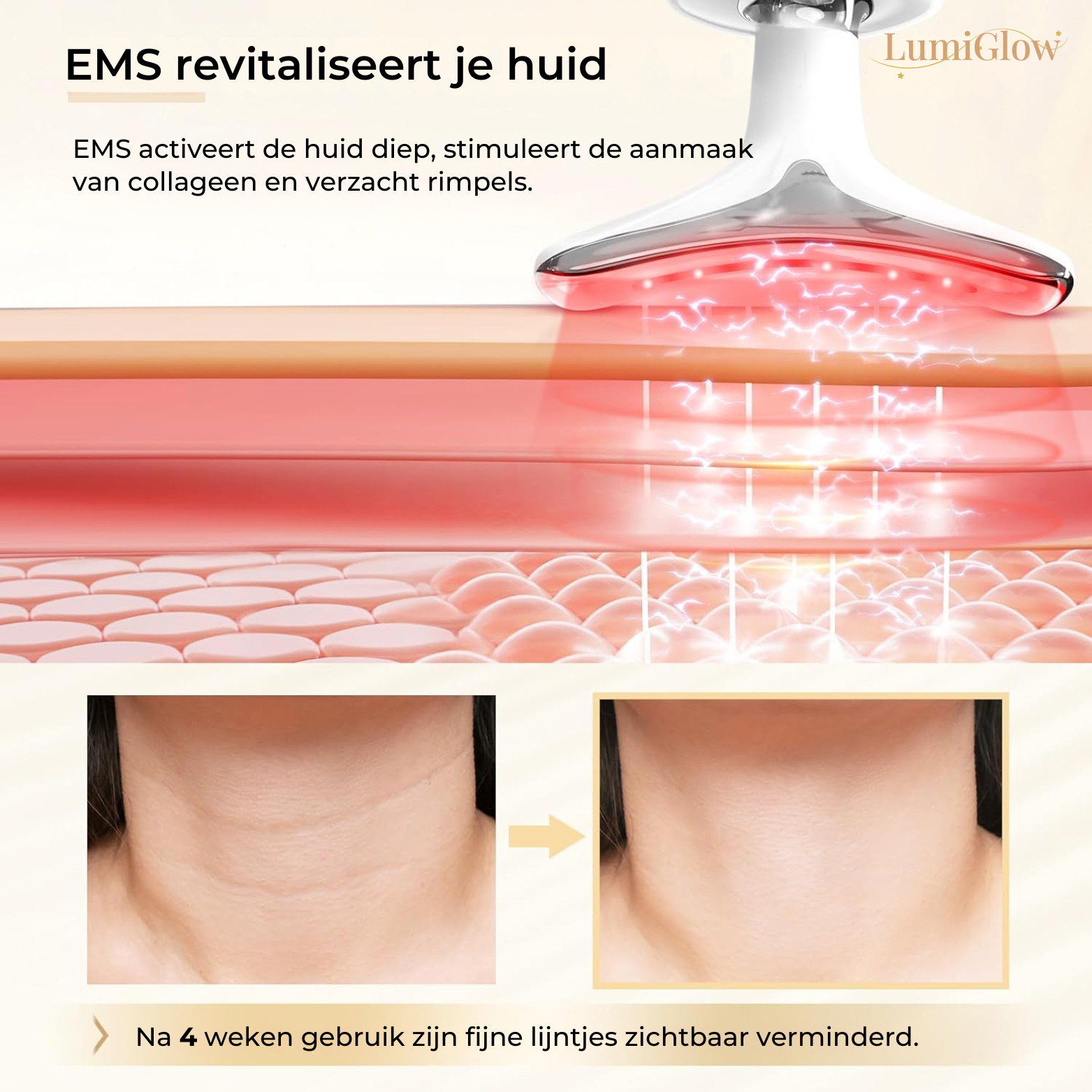 LumiGlow Gezichtsapparaat tegen Rimpels – EMS & Lifting