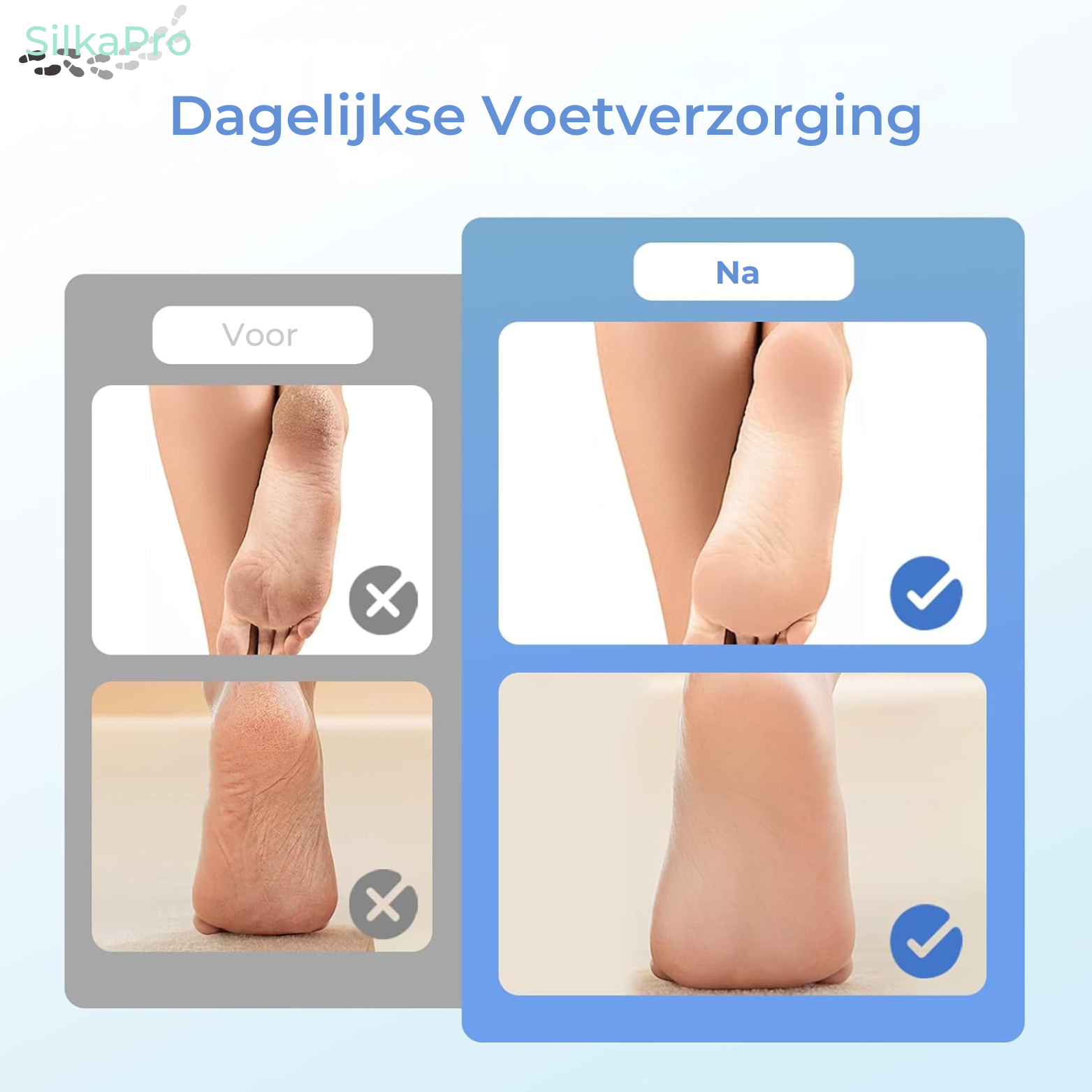 SilkaPro Elektrische Eeltverwijderaar