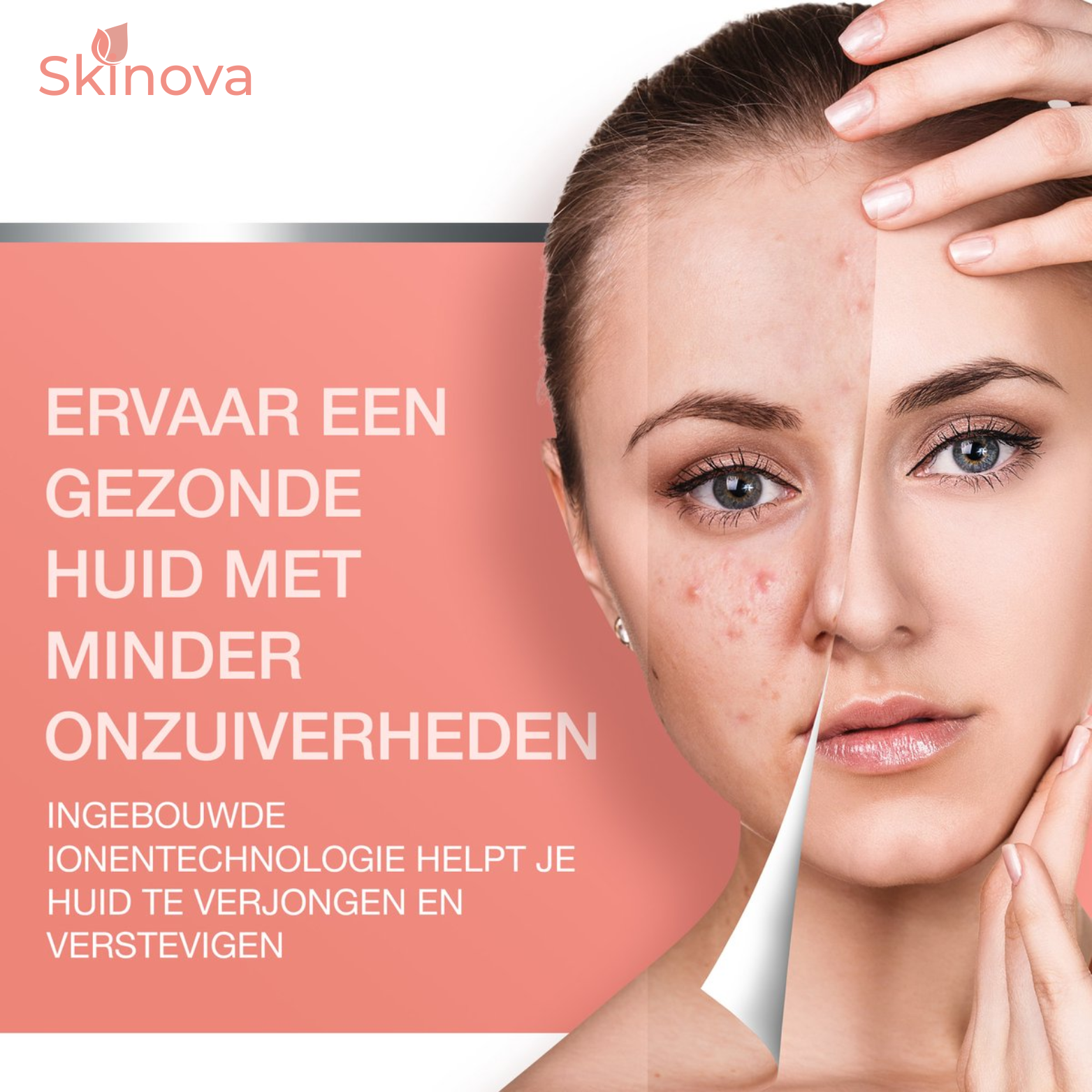 Skinova Ultrasoon Gezichtsreiniger
